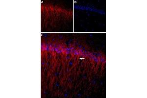 Expression of CACNB1 (CaVβ1) in rat hippocampus - Immunohistochemical staining of rat hippocampus using Anti-CACNB1 Antibody (ABIN7042984, ABIN7044049 and ABIN7044050). (CACNB1 anticorps  (C-Term, Intracellular))