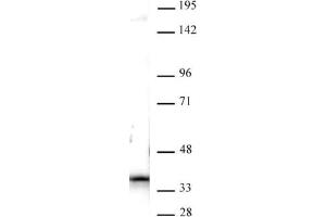 Nucleophosmin antibody (pAb) tested by Western blot. (NPM1 anticorps  (C-Term))