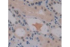 IHC-P analysis of Human Tissue, with DAB staining. (PRAME anticorps  (AA 416-502))