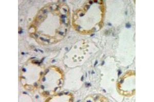 IHC-P analysis of kidney tissue, with DAB staining. (IL4 Receptor anticorps  (AA 26-233))