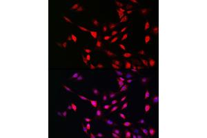 anti-Ubiquitin-Fold Modifier 1 (UFM1) (AA 1-85) antibody