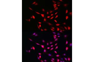 Immunofluorescence analysis of NIH/3T3 cells using UFM1 Rabbit pAb (ABIN7271184) at dilution of 1:150 (40x lens). (UFM1 anticorps  (AA 1-85))