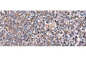 Immunohistochemistry of paraffin-embedded Human tonsil tissue using INSC Polyclonal Antibody at dilution of 1:65(x200) (INSC anticorps)
