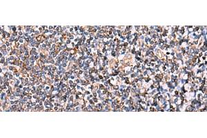 Immunohistochemistry of paraffin-embedded Human tonsil tissue using INSC Polyclonal Antibody at dilution of 1:65(x200)