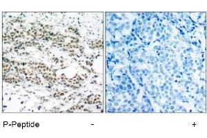 Image no. 1 for anti-Forkhead Box O4 (FOXO4) (pSer197) antibody (ABIN196850) (FOXO4 anticorps  (pSer197))