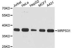 Western blot analysis of extracts of various cell lines, using MRPS31 antibody. (MRPS31 anticorps)