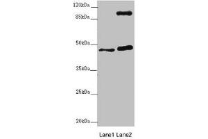 Western blot All lanes: AURKA antibody at 2 μg/mL Lane 1: NIH/3T3 whole cell lysate Lane 2: HT29 whole cell lysate Secondary Goat polyclonal to rabbit IgG at 1/10000 dilution Predicted band size: 46 kDa Observed band size: 46, 110 kDa (Aurora A anticorps  (AA 1-131))
