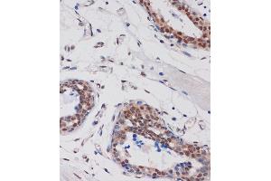 Immunohistochemistry of paraffin-embedded Human breast using B Rabbit pAb (ABIN7265702) at dilution of 1:100 (40x lens). (ARID1B anticorps  (AA 400-650))