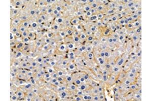 ABIN7096905 and ABIN7100971 at 1/100 staining mouse liver tissue by IHC-P. (BRPF3 anticorps)
