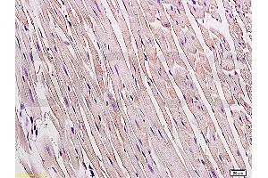 Formalin-fixed and paraffin embedded rat heart tissue labeled Anti-Connexin 43 Polyclonal Antibody, Unconjugated (ABIN671451) at 1:200, followed by conjugation to the secondary antibody and DAB staining (Connexin 43/GJA1 anticorps  (AA 211-260))