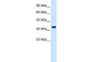 WB Suggested Anti-ZNF2 Antibody Titration:  1. (ZNF2 anticorps  (N-Term))