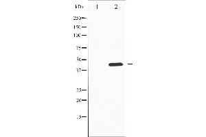 Western blot analysis of Tyrosine Hydroxylase phosphorylation expression in PC12 whole cell lysates,The lane on the left is treated with the antigen-specific peptide. (Tyrosine Hydroxylase anticorps  (pSer19))