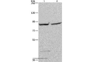 Western blot analysis of 293T and Hela cell, using GYS1 Polyclonal Antibody at dilution of 1:400 (Glycogen Synthase 1 anticorps)