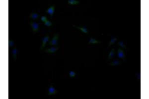 Immunofluorescence staining of HepG2 cells with ABIN7153367 at 1:133, counter-stained with DAPI. (GPRC6A anticorps  (AA 403-581))