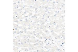 Immunohistochemistry of paraffin-embedded Human liver using CD20 antibody (ABIN7268472) at dilution of 1:100 (40x lens). (CD20 anticorps)