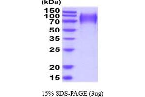 SDS-PAGE (SDS) image for Podocalyxin-Like (PODXL) (AA 22-404) protein (His tag) (ABIN5854527)