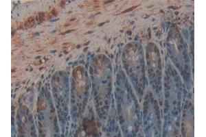 IHC-P analysis of Mouse Intestine Tissue, with DAB staining. (CPB2 anticorps  (AA 113-422))