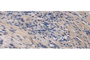 Immunohistochemistry of paraffin-embedded Human brain tissue using KLF1 Polyclonal Antibody at dilution of 1:35(x200)
