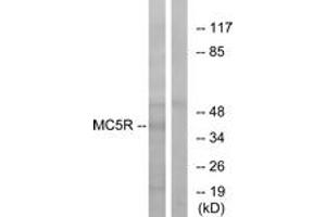 Western blot analysis of extracts from K562 cells, using MC5R Antibody. (MC5 Receptor anticorps  (AA 271-320))