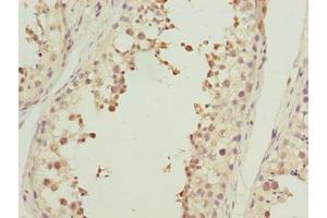 Immunohistochemistry of paraffin-embedded human testis tissue using ABIN7143059 at dilution of 1:100 (Actl7b anticorps  (AA 1-415))