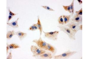 ICC testing of A549 cells (DCI anticorps  (C-Term))