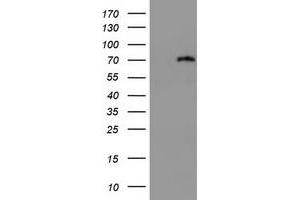 Image no. 1 for anti-DEAD (Asp-Glu-Ala-Asp) Box Polypeptide 59 (DDX59) (AA 1-303) antibody (ABIN1490733) (DDX59 anticorps  (AA 1-303))