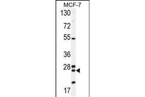 Western blot analysis in MCF-7 cell line lysates (35ug/lane). (NUDT8 anticorps  (N-Term))