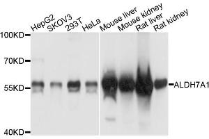 Western blot analysis of extracts of various cell lines, using ALDH7A1 antibody. (ALDH7A1 anticorps)