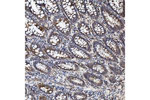 IHC analysis of TJP2/ZO2 using anti-TJP2/ZO2 antibody (ABIN7602800).