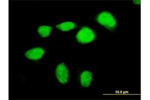 Immunofluorescence of purified MaxPab antibody to MEF2D on HeLa cell. (MEF2D anticorps  (AA 1-521))