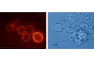 Expression of Bombesin receptor 2 in human HT-29 cells - Cell surface detection of BB2 receptor in live intact human HT-29 (colorectal adenocarcinoma) cells.