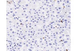 Immunohistochemistry analysis of paraffin-embedded human liver using MPO Polyclonal Antibody at dilution of 1:300. (Myeloperoxidase anticorps)