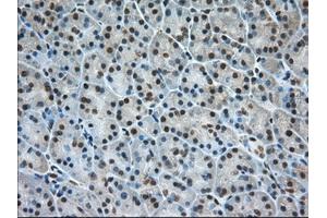 Immunohistochemical staining of paraffin-embedded Human Kidney tissue using anti-ERCC1 mouse monoclonal antibody. (ERCC1 anticorps)