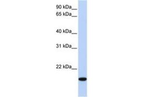 Image no. 1 for anti-Homeobox even-skipped homolog protein 2 (EVX2) (AA 154-203) antibody (ABIN6744266) (EVX2 anticorps  (AA 154-203))