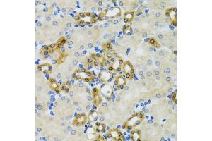 Immunohistochemistry of paraffin-embedded mouse kidney using PHPT1 antibody (ABIN5970475) at dilution of 1/100 (40x lens).