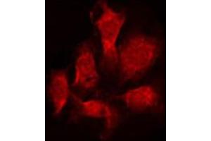 anti-STEAP Family Member 4 (STEAP4) (C-Term) antibody