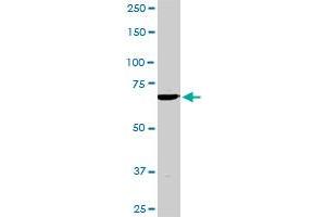 TBX3 monoclonal antibody (M02), clone 8H3.
