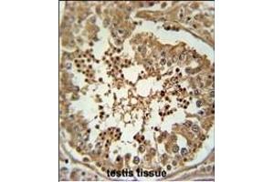 C Antibody (Center) (ABIN653885 and ABIN2843132) immunohistochemistry analysis in formalin fixed and paraffin embedded human testis tissue followed by peroxidase conjugation of the secondary antibody and DAB staining. (C3orf58 anticorps  (AA 159-188))