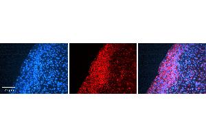 Rabbit Anti-MMP2 Antibody  AV Formalin Fixed Paraffin Embedded Tissue: Human Urinary Bladder Tissue Observed Staining: Cytoplasm Primary Antibody Concentration: 1:100 Other Working Concentrations: N/A Secondary Antibody: Donkey anti-Rabbit-Cy3 Secondary Antibody Concentration: 1:200 Magnification: 20X Exposure Time: 0.