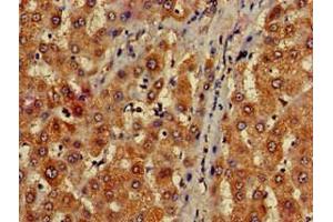 Immunohistochemistry of paraffin-embedded human liver tissue using ABIN7159786 at dilution of 1:100 (LC3C anticorps  (AA 1-30))