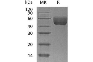 Western Blotting (WB) image for Basigin (Ok Blood Group) (BSG) (AA 22-325) protein (His tag) (ABIN7320724)