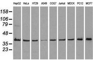 Western blot analysis of extracts (35 µg) from 9 different cell lines by using anti-MAPK1 monoclonal antibody. (ERK2 anticorps)