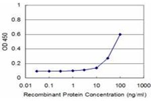 anti-Forkhead Box F2 (FOXF2) (AA 207-340) antibody