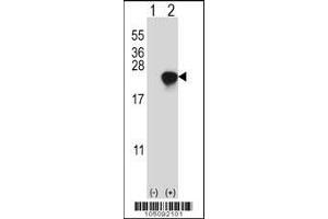 Western blot analysis of ARL2 using rabbit polyclonal ARL2 Antibody (D170) using 293 cell lysates (2 ug/lane) either nontransfected (Lane 1) or transiently transfected (Lane 2) with the ARL2 gene. (ARL2 anticorps  (C-Term))
