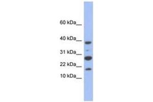 Image no. 1 for anti-NADH Dehydrogenase (Ubiquinone) 1, Subcomplex Unknown, 1, 6kDa (NDUFC1) (C-Term) antibody (ABIN6744061) (NDUFC1 anticorps  (C-Term))