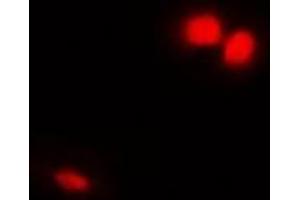 Immunofluorescent analysis of Emerin staining in Hela cells.