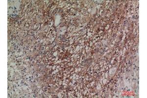 Immunohistochemistry (IHC) analysis of paraffin-embedded Human Brain, antibody was diluted at 1:100.