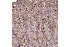 Immunohistochemical staining of human stomach with AGXT2L1 polyclonal antibody  shows distinct nuclear and cytoplasmic positivity in glandular cells. (AGXT2L1 anticorps)