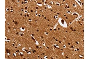 The image is immunohistochemistry of paraffin-embedded Human brain tissue using ABIN7131549(UPK3B Antibody) at dilution 1/25. (Uroplakin 3B anticorps)