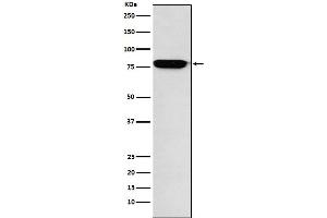 Western blot analysis of RANK expression in Human fetal liver lysate.